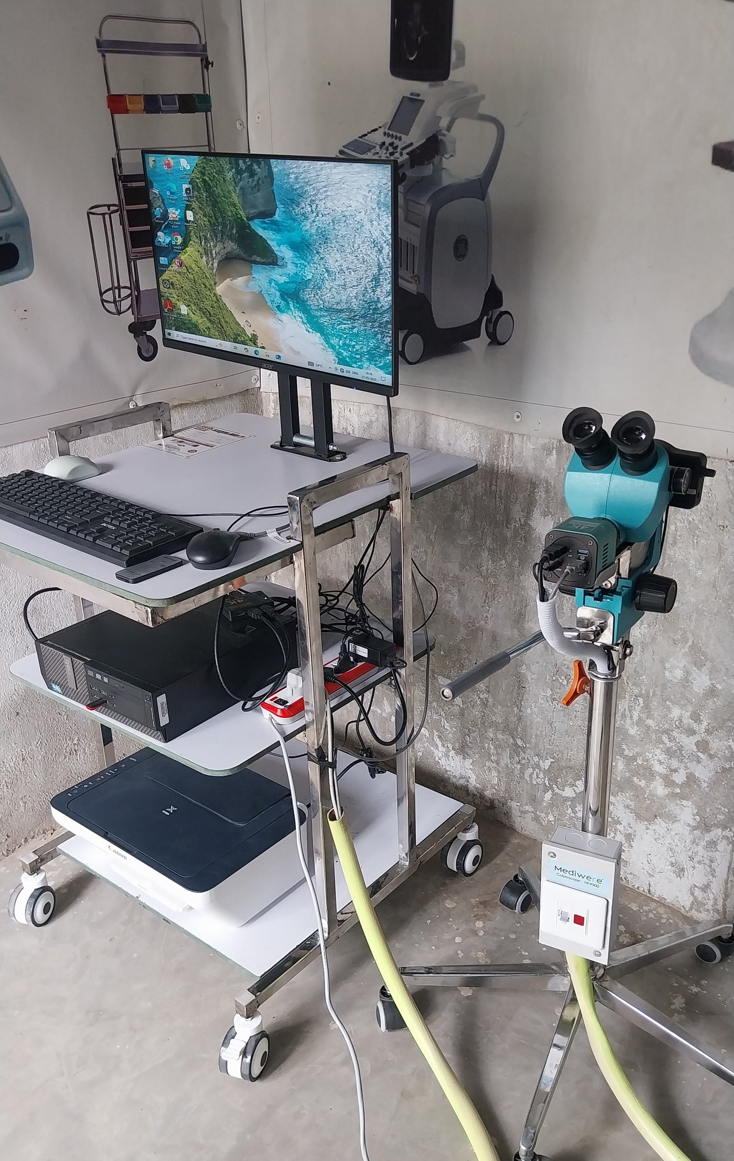 Colposcope HF4900 Optical Video for gynecology examination imaging system