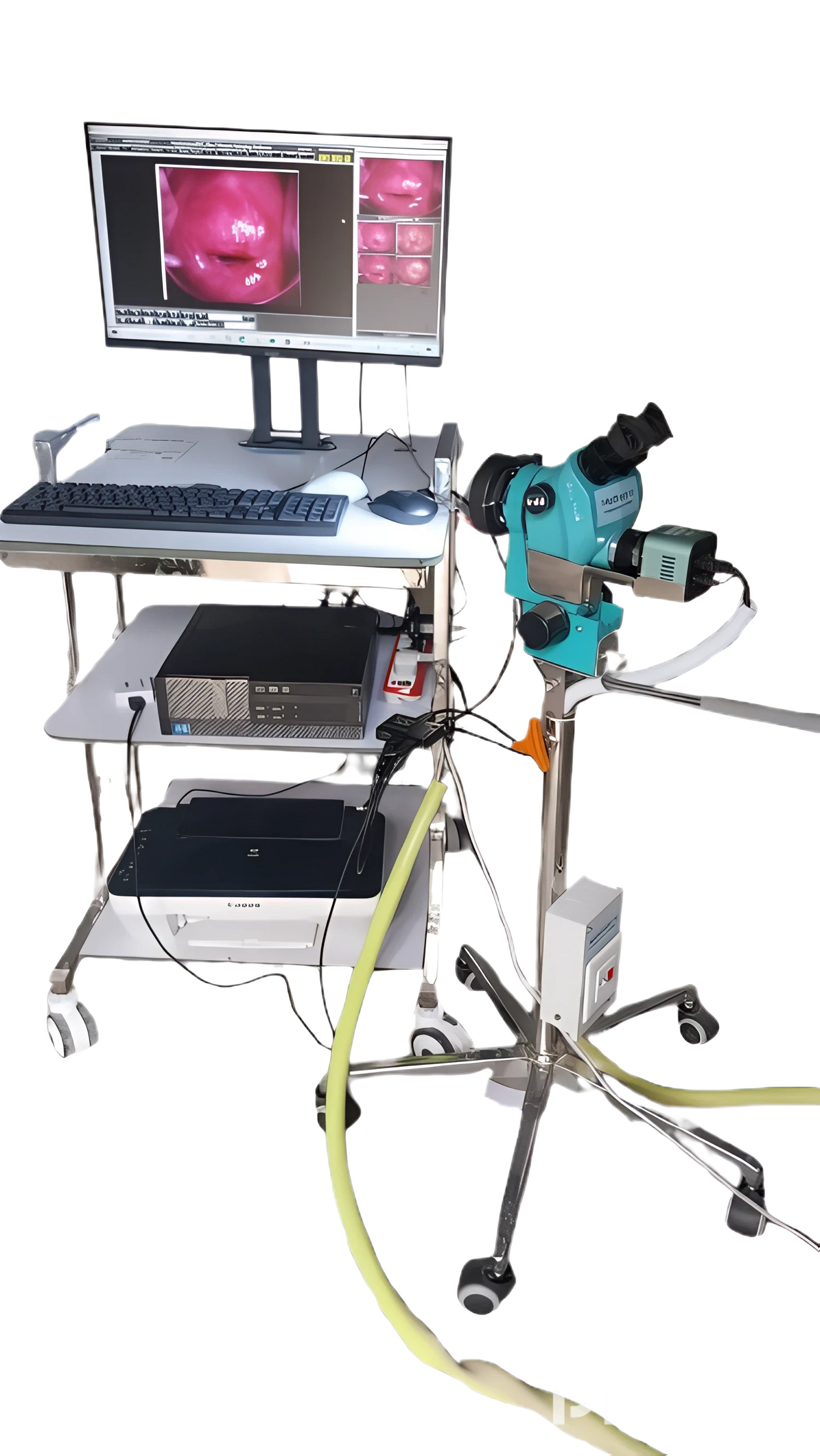 Colposcope HF4900 Optical Video for gynecology examination imaging system