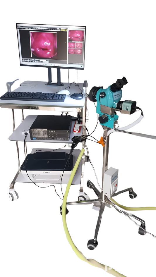 Colposcope  HF4900   Optical Video  for gynecology examination imaging system